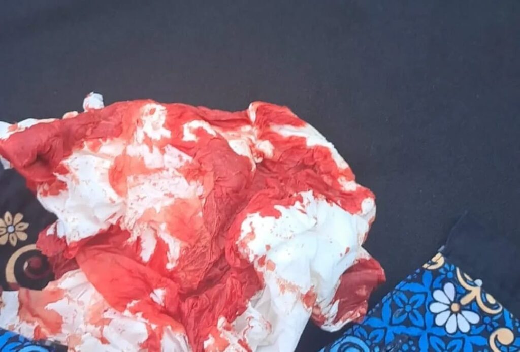 Alami Dugaan Tindak Kekerasan Oleh Rekan Kerja, ASN Pemkab Gresik Lapor Polisi